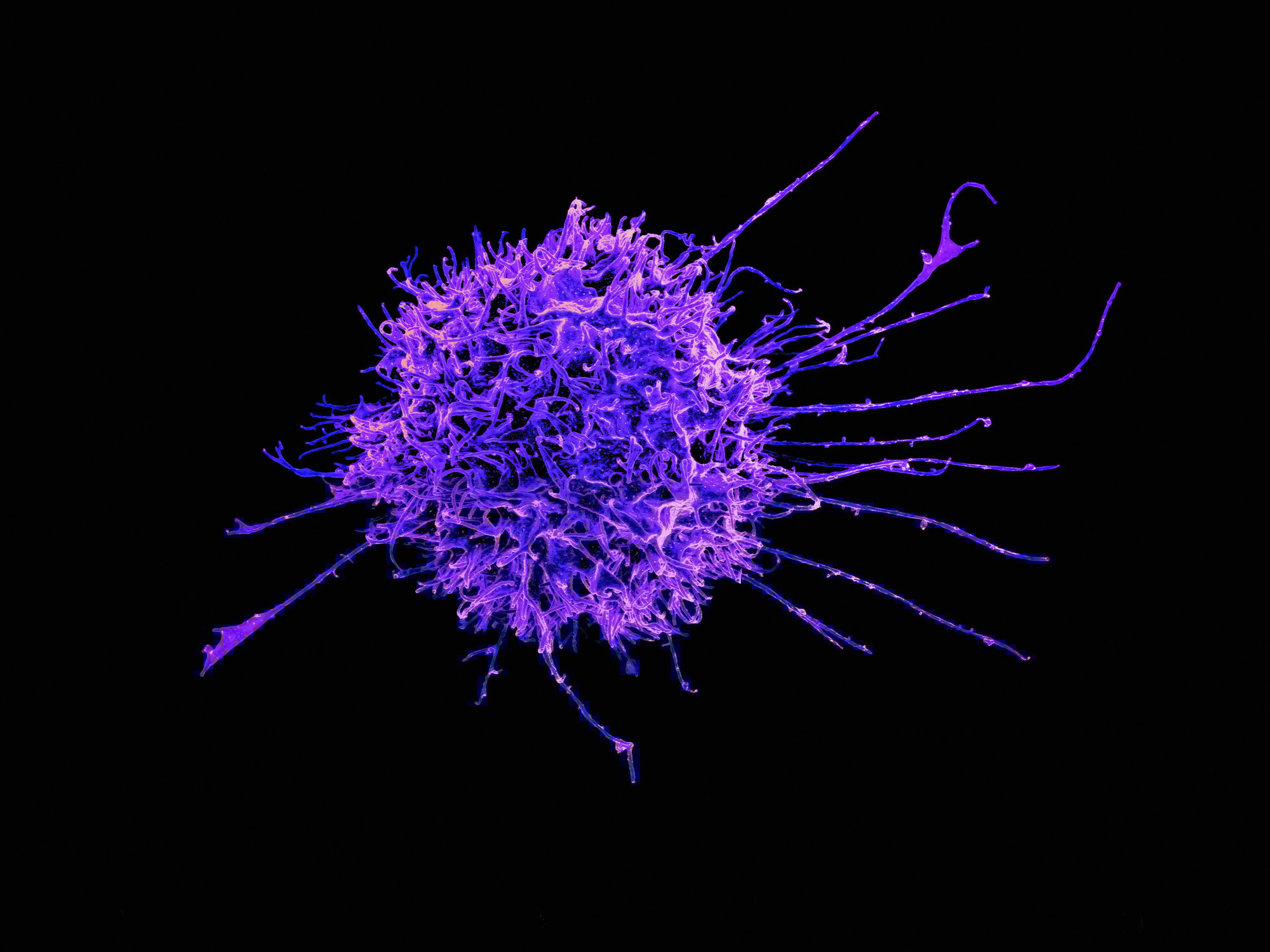 Natural killer Cell